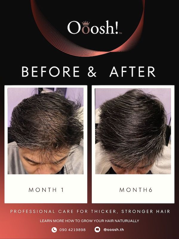 Before & After FB/IG 3:4 1080×1440 – 2