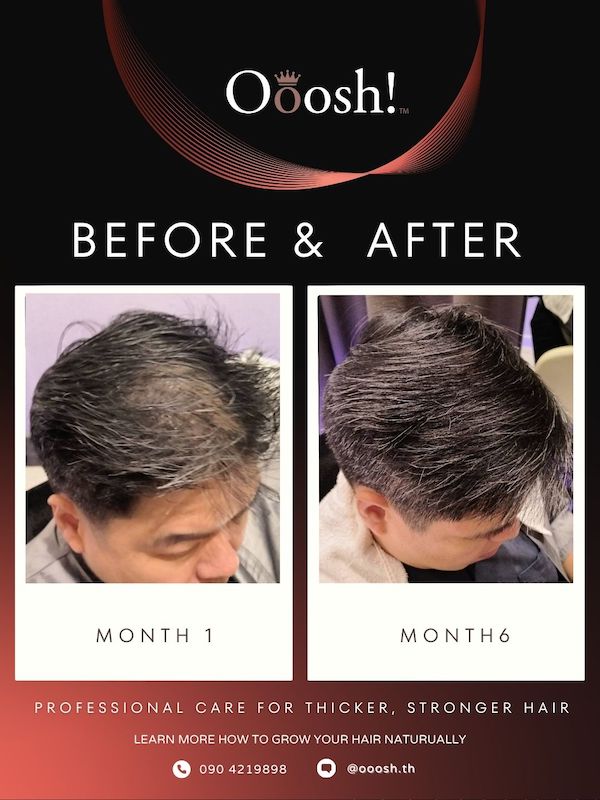 Before & After FB/IG 3:4 1080×1440 – 3