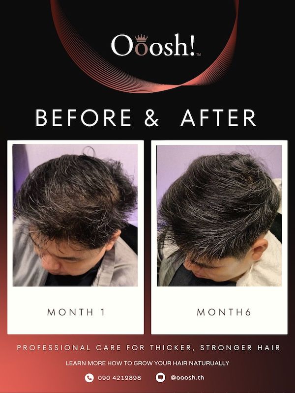 Before & After FB/IG 3:4 1080×1440 – 4