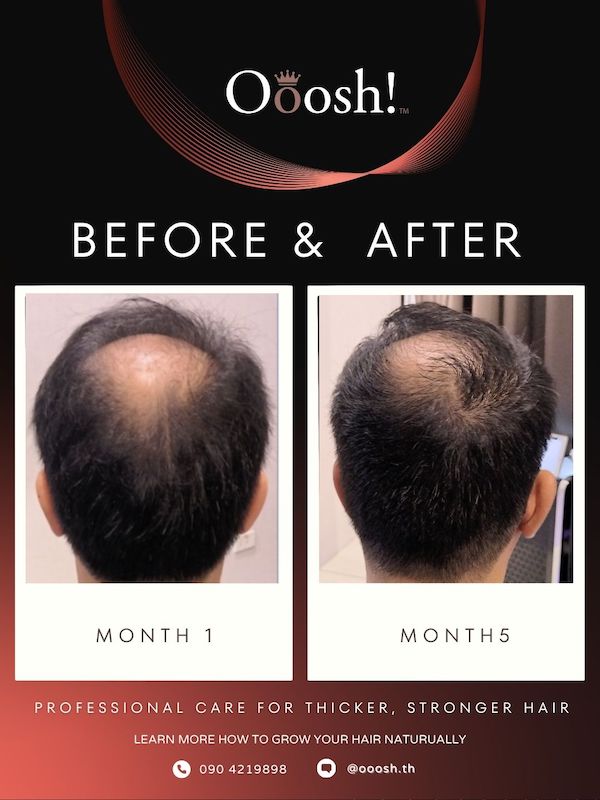 Before & After FB/IG 3:4 1080×1440 – 5