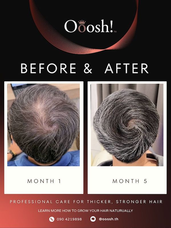 Before & After FB/IG 3:4 1080×1440 – 7