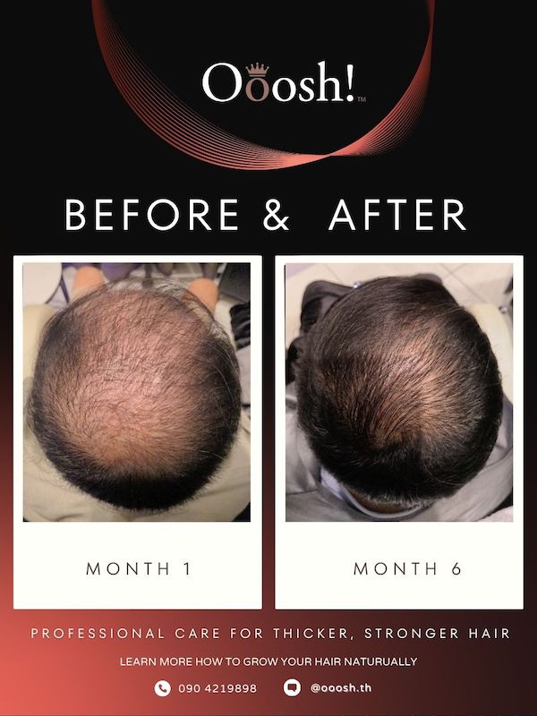 Before & After FB/IG 3:4 1080×1440 – 8