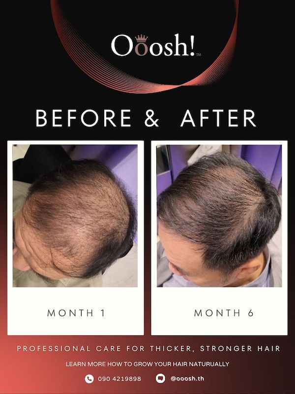 Before & After FB/IG 3:4 1080×1440 – 9