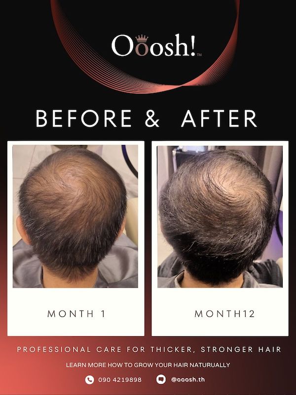 Before & After FB/IG 3:4 1080×1440 – 10