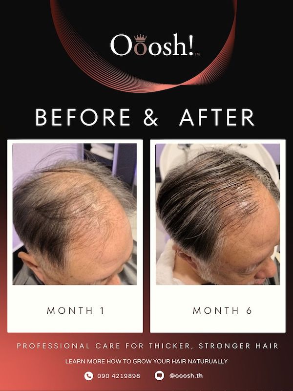 Before & After FB/IG 3:4 1080×1440 – 11