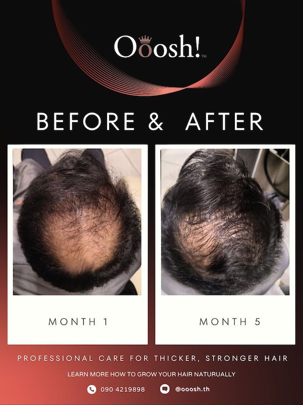 Before & After FB/IG 3:4 1080×1440 – 2