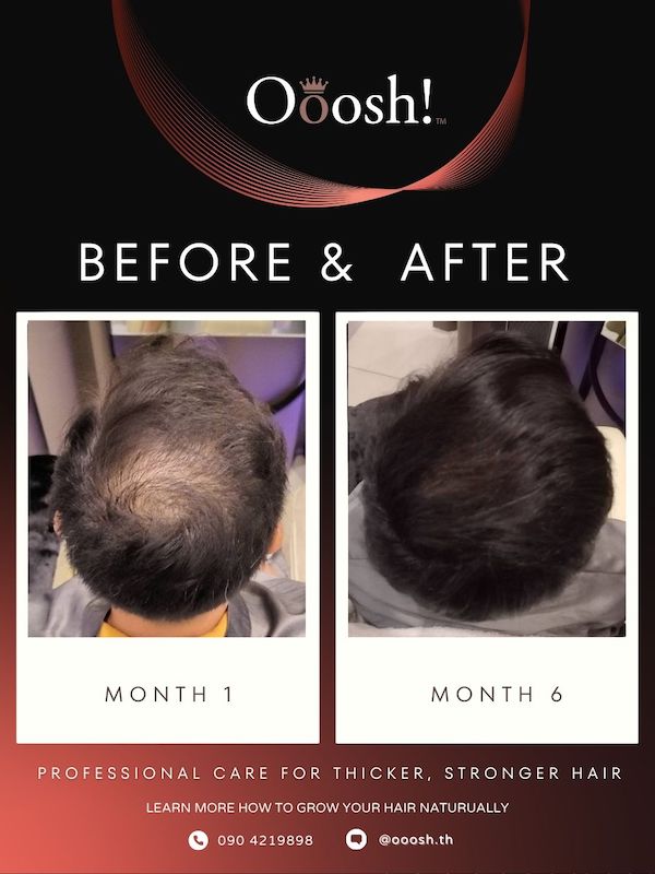 Before & After FB/IG 3:4 1080×1440 – 3