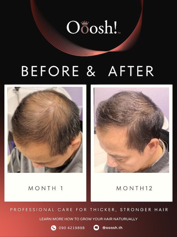 Before & After FB/IG 3:4 1080×1440 – 12
