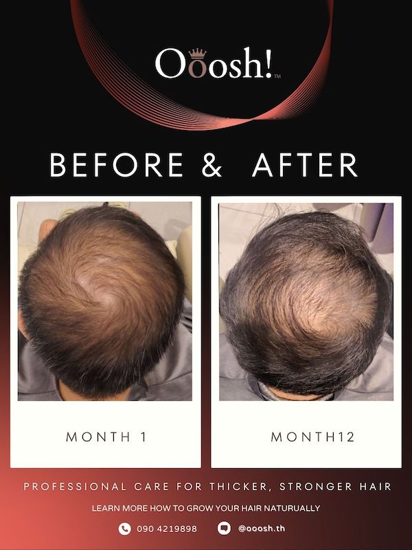 Before & After FB/IG 3:4 1080×1440 – 13