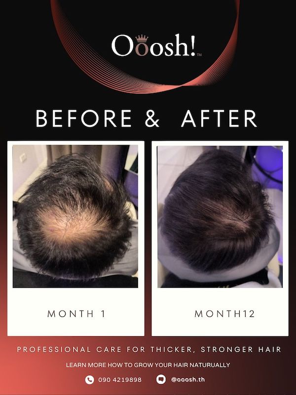 Before & After FB/IG 3:4 1080×1440 – 14