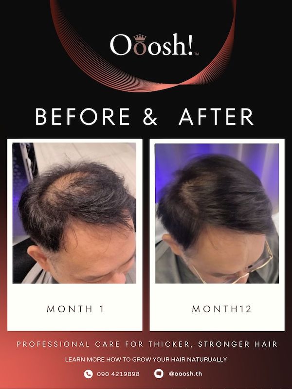 Before & After FB/IG 3:4 1080×1440 – 15