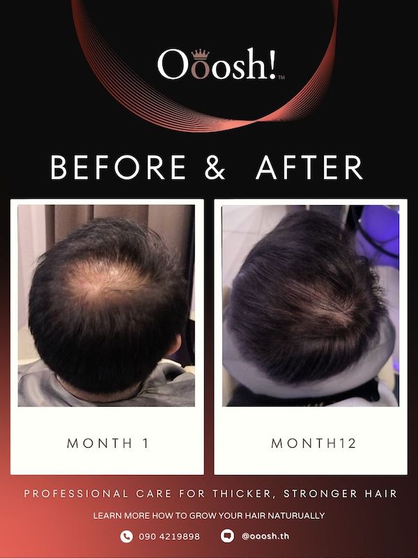 Before & After FB/IG 3:4 1080×1440 – 16