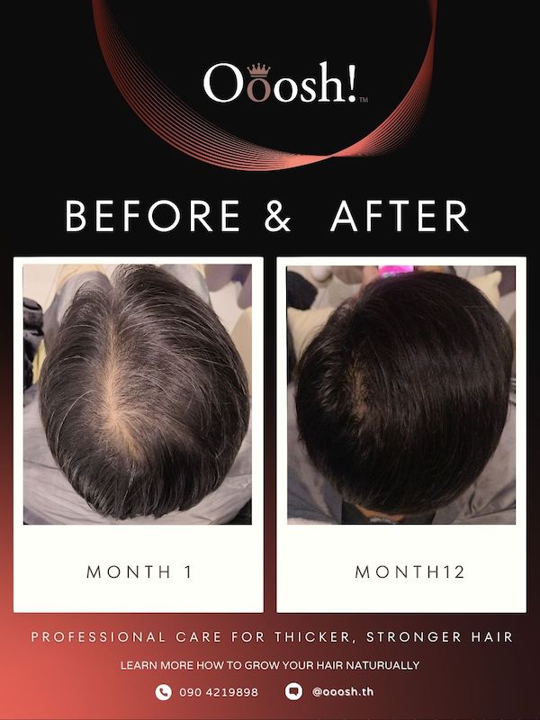 Before & After FB/IG 3:4 1080×1440 – 17
