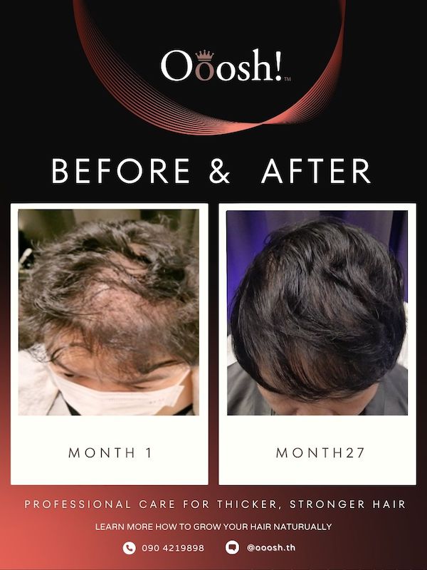 Before & After FB/IG 3:4 1080×1440 – 18