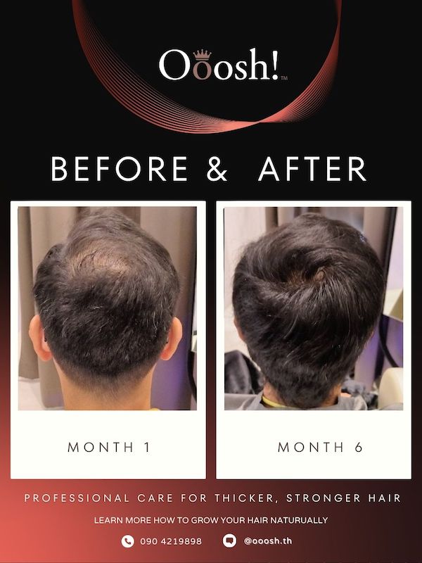 Before & After FB/IG 3:4 1080×1440 – 1